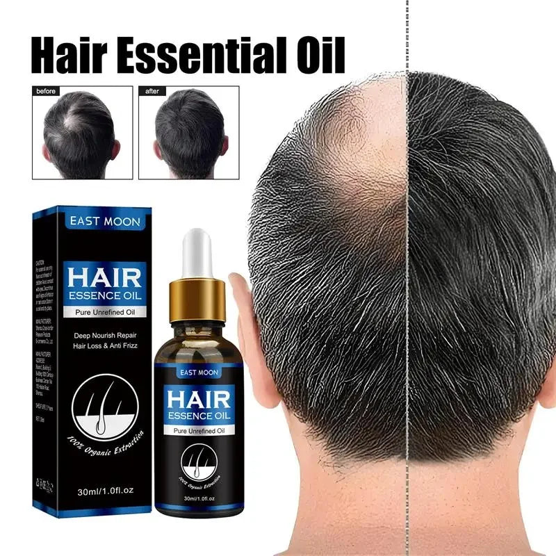 Hair Growth Oil Fast Hair Growth Effective Baldness Repair Hereditary Hair Loss Postpartum