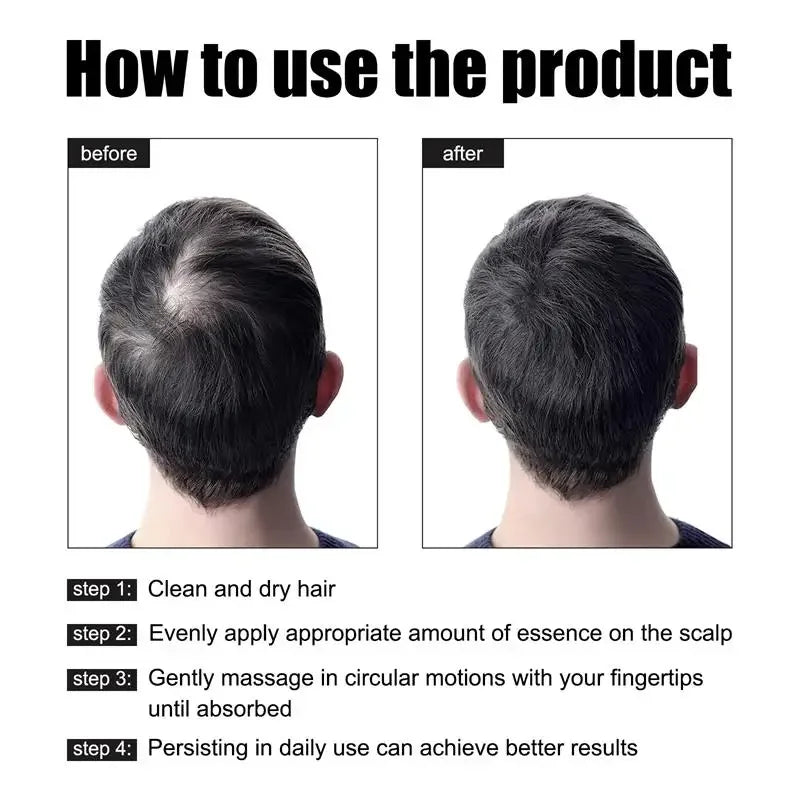 Hair Growth Oil Fast Hair Growth Effective Baldness Repair Hereditary Hair Loss Postpartum